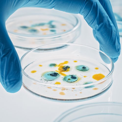 Cell culture in Pedri dish