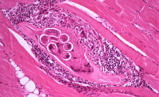 Trichinella, Mikrobiologie, Mikrobielle Risiken, Parasiten Mikroskopaufnahme von Trichinella