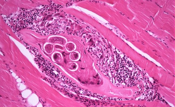 Trichinella, Mikrobiologie, Mikrobielle Risiken, Parasiten Mikroskopaufnahme von Trichinella