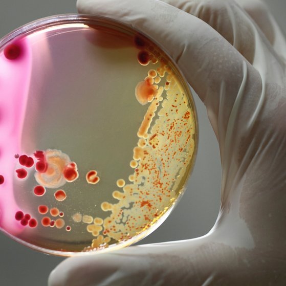 Bakterien The agar dish is held up with two fingers
