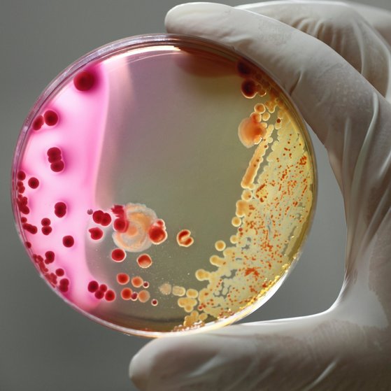 Agarschale wird mit zwei Fingern hochgehalten.