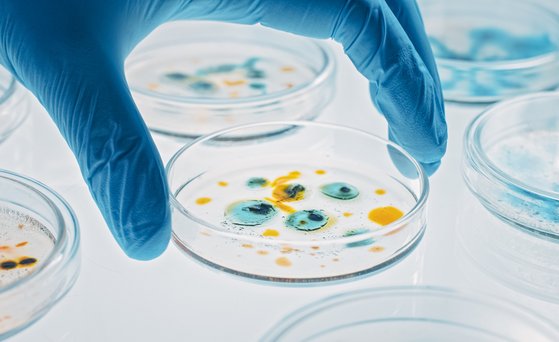 Mikrobiologie Hand trägt blauen Handschuh und hält Petrischle mit blau-gelber Kultur.