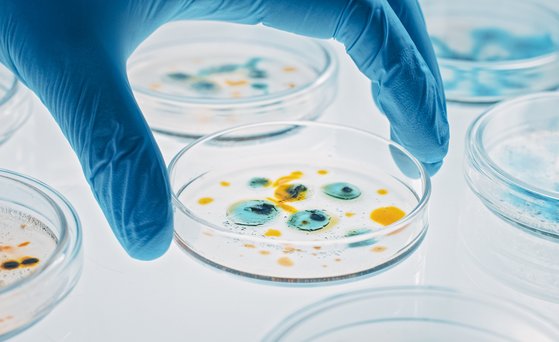 Hand trägt blauen Handschuh und hält Petrischle mit blau-gelber Kultur.