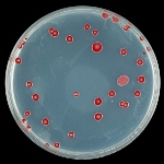 Campylobacter Campylobacter