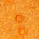 Trichinella Trichinella